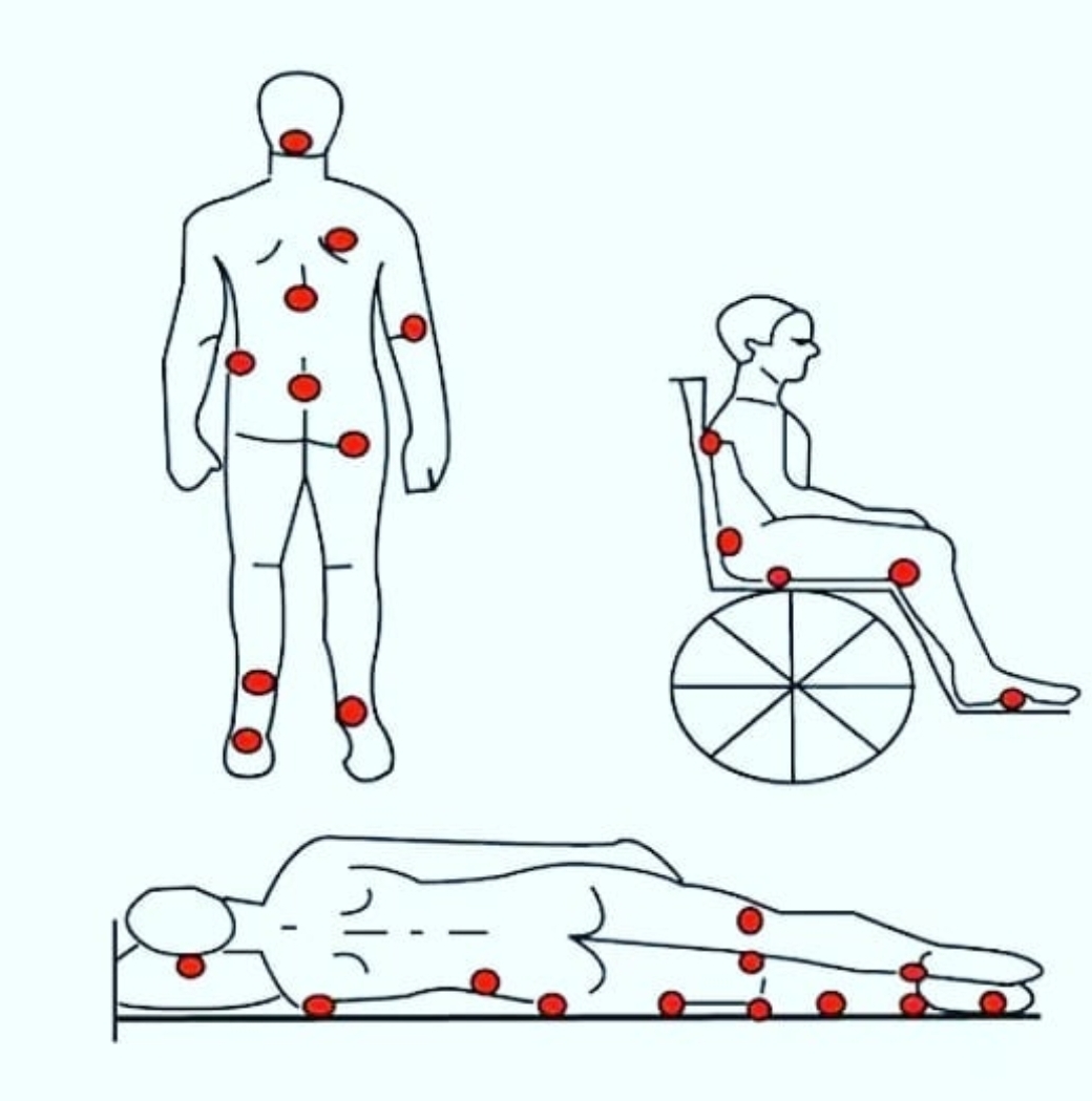 basi-yarasi-karikatur
