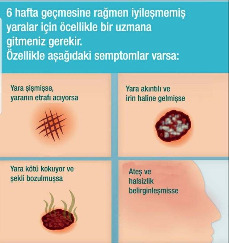 yara-bakim-5